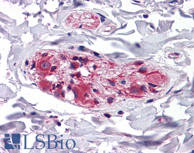 KLHL3 Antibody - Anti-KLHL3 antibody IHC of human colon. Immunohistochemistry of formalin-fixed, paraffin-embedded tissue after heat-induced antigen retrieval. Antibody concentration 5 ug/ml.  This image was taken for the unconjugated form of this product. Other forms have not been tested.