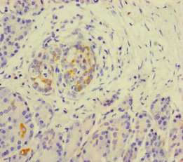 KLHL3 Antibody - Immunohistochemistry of paraffin-embedded human pancreatic tissue at dilution of 1:100