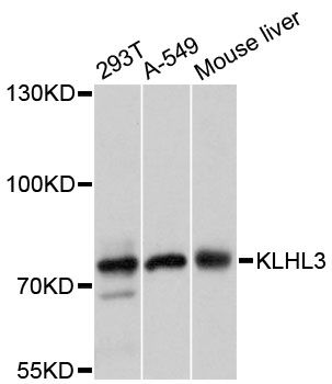 KLHL3 Antibody - Western blot analysis of extracts of various cell lines, using KLHL3 antibody at 1:3000 dilution. The secondary antibody used was an HRP Goat Anti-Rabbit IgG (H+L) at 1:10000 dilution. Lysates were loaded 25ug per lane and 3% nonfat dry milk in TBST was used for blocking. An ECL Kit was used for detection and the exposure time was 1s.