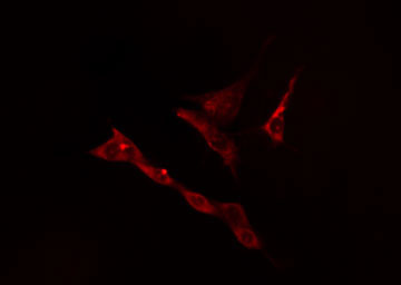 KLHL3 Antibody - Staining RAW264.7 cells by IF/ICC. The samples were fixed with PFA and permeabilized in 0.1% Triton X-100, then blocked in 10% serum for 45 min at 25°C. The primary antibody was diluted at 1:200 and incubated with the sample for 1 hour at 37°C. An Alexa Fluor 594 conjugated goat anti-rabbit IgG (H+L) antibody, diluted at 1/600, was used as secondary antibody.