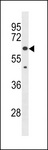 KLHL30 Antibody - KLHL30 Antibody western blot of A549 cell line lysates (35 ug/lane). The KLHL30 antibody detected the KLHL30 protein (arrow).