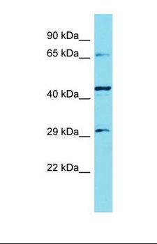 KLHL30 Antibody - Western blot of Human Hela. KLHL30 antibody dilution 1.0 ug/ml.  This image was taken for the unconjugated form of this product. Other forms have not been tested.