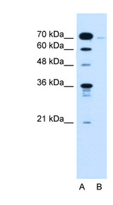 KLHL31 Antibody - KLHL31 antibody ARP44458_P050-NP_001003760-KLHL31(kelch-like 31 (Drosophila)) Antibody Western blot of Jurkat lysate.  This image was taken for the unconjugated form of this product. Other forms have not been tested.