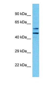 KLHL33 Antibody - Western blot of KLHL33 Antibody with human MCF7 Whole Cell lysate.  This image was taken for the unconjugated form of this product. Other forms have not been tested.