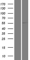 KLHL33 Protein - Western validation with an anti-DDK antibody * L: Control HEK293 lysate R: Over-expression lysate