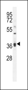 KLHL35 Antibody - KLHL35 Antibody western blot of MDA-MB231 cell line lysates (35 ug/lane). The KLHL35 antibody detected the KLHL35 protein (arrow).