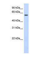 KLHL42 / KLHDC5 Antibody - KLHDC5 antibody Western blot of Transfected 293T cell lysate. This image was taken for the unconjugated form of this product. Other forms have not been tested.