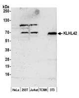 KLHL42 / KLHDC5 Antibody - Detection of human and mouse KLHL42 by western blot. Samples: Whole cell lysate (50 µg) from HeLa, HEK293T, Jurkat, mouse TCMK-1, and mouse NIH 3T3 cells prepared using NETN lysis buffer. Antibody: Affinity purified rabbit anti-KLHL42 antibody used for WB at 1:1000. Detection: Chemiluminescence with an exposure time of 3 minutes.