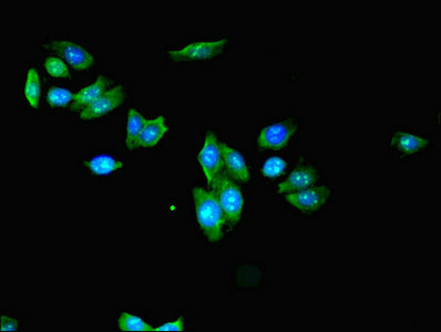 KLHL42 / KLHDC5 Antibody - Immunofluorescent analysis of HepG2 cells using KLHL42 Antibody at dilution of 1:100 and Alexa Fluor 488-congugated AffiniPure Goat Anti-Rabbit IgG(H+L)