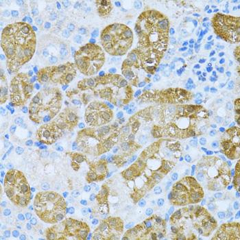 KLHL42 / KLHDC5 Antibody - Immunohistochemistry of paraffin-embedded Mouse kidney using KLHL42 Polyclonal Antibody at dilution of 1:100 (40x lens).