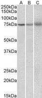 KLHL6 Antibody - Goat Anti-KLHL6 / Kelch-like 6 Antibody (2?/ml) staining of Human (A), Mouse (B) and Rat (C) Spleen lysate (35? protein in RIPA buffer). Primary incubation was 1 hour. Detected by chemiluminescence.