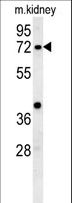 KLHL6 Antibody - KLHL6 Antibody western blot of mouse kidney tissue lysates (15 ug/lane). The KLHL6 antibody detected KLHL6 protein (arrow).