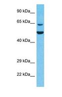 KLHL6 Antibody - Western blot of KLHL6 Antibody with human 293T Whole Cell lysate.  This image was taken for the unconjugated form of this product. Other forms have not been tested.