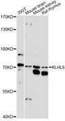 KLHL8 Antibody - Western blot analysis of extracts of various cell lines, using KLHL8 antibody at 1:1000 dilution. The secondary antibody used was an HRP Goat Anti-Rabbit IgG (H+L) at 1:10000 dilution. Lysates were loaded 25ug per lane and 3% nonfat dry milk in TBST was used for blocking. An ECL Kit was used for detection and the exposure time was 90s.