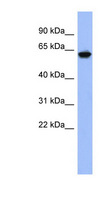 KLHL8 Antibody - KLHL8 antibody Western blot of Fetal Thymus lysate. This image was taken for the unconjugated form of this product. Other forms have not been tested.