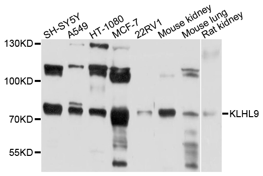 KLHL9 Antibody - Western blot analysis of extracts of various cell lines, using KLHL9 antibody at 1:1000 dilution. The secondary antibody used was an HRP Goat Anti-Rabbit IgG (H+L) at 1:10000 dilution. Lysates were loaded 25ug per lane and 3% nonfat dry milk in TBST was used for blocking. An ECL Kit was used for detection and the exposure time was 15s.