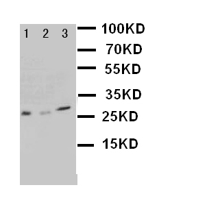 KLK1 / Kallikrein 1 Antibody - WB of KLK1 / Kallikrein 1 antibody. Lane 1: Recombinant Human KLK1 Protein 10ng. Lane 2: Recombinant Human KLK1 Protein 5ng . Lane 3: Recombinant Human KLK1 Protein 2.5ng.