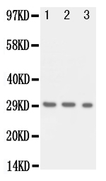 KLK1 / Kallikrein 1 Antibody - Anti-Kallikrein 1 antibody, Western blotting Lane 1: Recombinant Human KLK1 Protein 10ng Lane 2: Recombinant Human KLK1 Protein 5ng Lane 3: Recombinant Human KLK1 Protein 2. 5ng