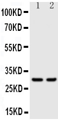 KLK1 / Kallikrein 1 Antibody - Anti-Kallikrein 1 antibody, Western blotting Lane 1: Rat Pancreas Tissue Lysate Lane 2: Rat Kidney Tissue Lysate