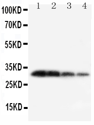 KLK1 / Kallikrein 1 Antibody - Anti-Kallikrein 1 antibody, Western blotting Lane 1: Recombinant Mouse KLK1 Protein 10ng Lane 2: Recombinant Mouse KLK1 Protein 5ng Lane 3: Recombinant Mouse KLK1 Protein 2. 5ng Lane 4: Recombinant Mouse KLK1 Protein 1. 25ng