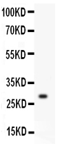 KLK1 / Kallikrein 1 Antibody - Anti-Kallikrein 1 antibody,Western blotting All lanes: Anti Kallikrein 1 at 0.5ug/mlWB: Mouse Testis Tissue Lysate at 50ugPredicted bind size: 29KD Observed bind size: 29KD