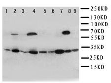 KLK10 / Kallikrein 10 Antibody - WB of KLK10 / Kallikrein 10 antibody. Lane 1:Rat Ovary Tissue Lysate. Lane2: Rat Testis Tissue Lysate. Lane3: Rat Spleen Tissue Lysate. Lane4: Rat Liver Tissue Lysate. Lane 5: 22RV Cell Lysate. Lane 6: SROV Cell Lysate . Lane 7: HELA Cell Lysate. Lane8: MCF-7 Cell Lysate. Lane9: M231 Cell Lysate.