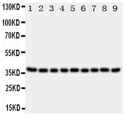 KLK10 / Kallikrein 10 Antibody - Anti-Kallikrein 10 antibody, Western blotting All lanes: Anti Kallikrein 10 at 0.5ug/ml Lane 1: Rat Ovary Tissue Lysate at 50ug Lane 2: Rat Testis Tissue Lysate at 50ug Lane 3: Rat Spleen Tissue Lysate at 50ug Lane 4: Rat Liver Tissue Lysate at 50ug Lane 5: 22RV Whole Cell Lysate at 40ug Lane 6: SROV Whole Cell Lysate at 40ug Lane 7: HELA Whole Cell Lysate at 40ug Lane 8: MCF-7 Whole Cell Lysate at 40ug Lane 9: MM231 Whole Cell Lysate at 40ug Predicted bind size: 37KD Observed bind size: 37KD