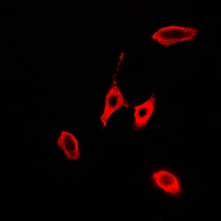 KLK10 / Kallikrein 10 Antibody - Immunofluorescent analysis of KLK10 staining in A549 cells. Formalin-fixed cells were permeabilized with 0.1% Triton X-100 in TBS for 5-10 minutes and blocked with 3% BSA-PBS for 30 minutes at room temperature. Cells were probed with the primary antibody in 3% BSA-PBS and incubated overnight at 4 deg C in a humidified chamber. Cells were washed with PBST and incubated with a DyLight 594-conjugated secondary antibody (red) in PBS at room temperature in the dark.