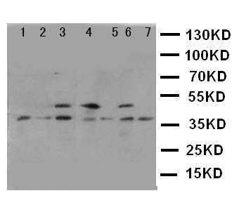 KLK11 / Kallikrein 11 Antibody - WB of KLK11 / Kallikrein 11 antibody. Lane 1: U87 Cell Lysate. Lane 2: A549 Cell Lysate. Lane 3: HELA Cell Lysate. Lane 4: M231 Cell Lysate. Lane 5: M453 Cell Lysate. Lane 6: COLO320 Cell Lysate. Lane 7: JURKAT Cell Lysate.