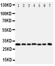 KLK11 / Kallikrein 11 Antibody - Anti-Kallikrein 11 antibody, Western blotting All lanes: Anti Kallikrein 11 at 0.5ug/ml Lane 1: U87 Whole Cell Lysate at 40ug Lane 2: A549 Whole Cell Lysate at 40ug Lane 3: HELA Whole Cell Lysate at 40ug Lane 4: MM231 Whole Cell Lysate at 40ug Lane 5: MM453 Whole Cell Lysate at 40ug Lane 6: COLO320 Whole Cell Lysate at 40ug Lane 7: JURKAT Whole Cell Lysate at 40ug Predicted bind size: 31KD Observed bind size: 31KD
