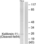 KLK11 / Kallikrein 11 Antibody - Western blot of extracts from HeLa cells, treated with etoposide 25 uM 24H, using Kallikrein-11 (Cleaved-Ile54) Antibody. The lane on the right is treated with the synthesized peptide.