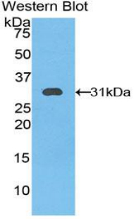 KLK11 / Kallikrein 11 Antibody - Western blot of recombinant KLK11 / Kallikrein 11.  This image was taken for the unconjugated form of this product. Other forms have not been tested.