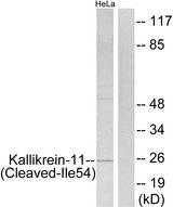 KLK11 / Kallikrein 11 Antibody - Western blot analysis of extracts from HeLa cells, treated with etoposide (25uM, 24hours), using Kallikrein-11 (Cleaved-Ile54) antibody.