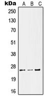 KLK11 / Kallikrein 11 Antibody - Western blot analysis of Kallikrein 11 expression in HeLa LPS-treated (A); SP2/0 UV-treated (B); PC12 LPS-treated (C) whole cell lysates.