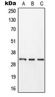 KLK11 / Kallikrein 11 Antibody - Western blot analysis of Kallikrein 11 expression in HEK293T (A); HepG2 (B); rat brain (C) whole cell lysates.