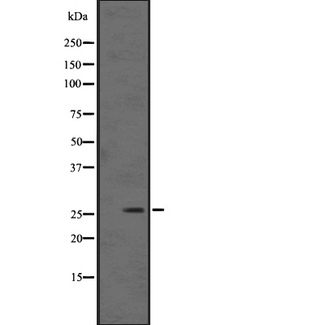 KLK12 / Kallikrein 12 Antibody - Western blot analysis of KLK12 expression in WiDr cells line lysates. The lane on the left is treated with the antigen-specific peptide.