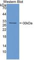 KLK13 / Kallikrein 13 Antibody - Western blot of KLK13 / Kallikrein 13 antibody.