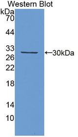 KLK13 / Kallikrein 13 Antibody - Western blot of KLK13 / Kallikrein 13 antibody.