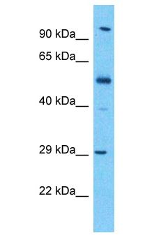 KLK13 / Kallikrein 13 Antibody - KLK13 / Kallikrein 13 antibody Western Blot of Esophagus Tumor. Antibody dilution: 1 ug/ml.  This image was taken for the unconjugated form of this product. Other forms have not been tested.