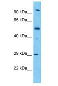KLK13 / Kallikrein 13 Antibody - KLK13 / Kallikrein 13 antibody Western Blot of Esophagus Tumor. Antibody dilution: 1 ug/ml.  This image was taken for the unconjugated form of this product. Other forms have not been tested.