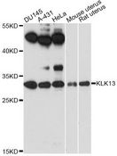 KLK13 / Kallikrein 13 Antibody - Western blot analysis of extracts of various cell lines, using KLK13 antibody at 1:3000 dilution. The secondary antibody used was an HRP Goat Anti-Rabbit IgG (H+L) at 1:10000 dilution. Lysates were loaded 25ug per lane and 3% nonfat dry milk in TBST was used for blocking. An ECL Kit was used for detection and the exposure time was 90s.
