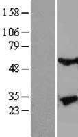 KLK13 / Kallikrein 13 Protein - Western validation with an anti-DDK antibody * L: Control HEK293 lysate R: Over-expression lysate