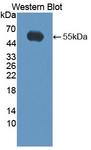 KLK14 / Kallikrein 14 Antibody - Western blot of KLK14 / Kallikrein 14 antibody.