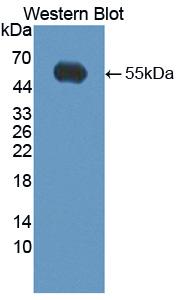 KLK14 / Kallikrein 14 Antibody - Western blot of KLK14 / Kallikrein 14 antibody.