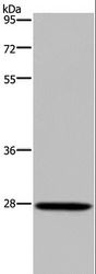 KLK14 / Kallikrein 14 Antibody - Western blot analysis of Mouse spleen tissue, using KLK14 Polyclonal Antibody at dilution of 1:300.