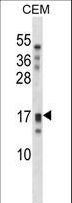 KLK15 / Kallikrein 15 Antibody - KLK15 Antibody western blot of CEM cell line lysates (35 ug/lane). The KLK15 antibody detected the KLK15 protein (arrow).