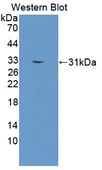 KLK2 / Kallikrein 2 Antibody - Western blot of KLK2 / Kallikrein 2 antibody.