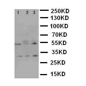 KLK2 / Kallikrein 2 Antibody - WB of KLK2 / Kallikrein 2 antibody. Lane 1: PANC Cell Lysate . Lane 2: HELA Cell Lysate. Lane 3: 293T Cell Lysate.