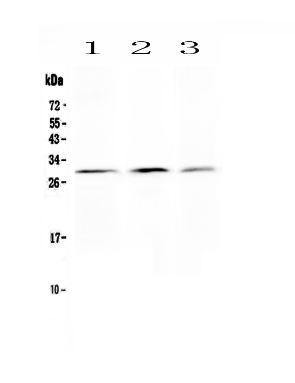KLK2 / Kallikrein 2 Antibody - Anti-Kallikrein 2 antibody, Western blotting All lanes: Anti Kallikrein 2 at 0.5ug/ml Lane 1: PANC Whole Cell Lysate at 40ug Lane 2: HELA Whole Cell Lysate at 40ug Lane 3: 293T Whole Cell Lysate at 40ug Predicted bind size: 29KD Observed bind size: 29KD
