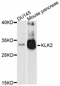 KLK2 / Kallikrein 2 Antibody - Western blot analysis of extracts of various cell lines.